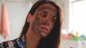 Blackhead Acne Treatment - Ways To Get Rid of Blackheads At Home