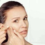 Homeopathic Acne Treatment - Can You Eradicate Acne With It?