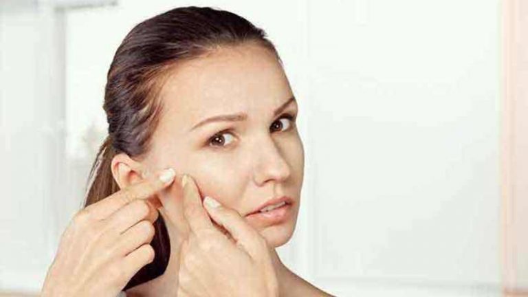Homeopathic Acne Treatment - Can You Eradicate Acne With It?