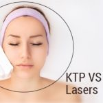 YAG Laser Treatment