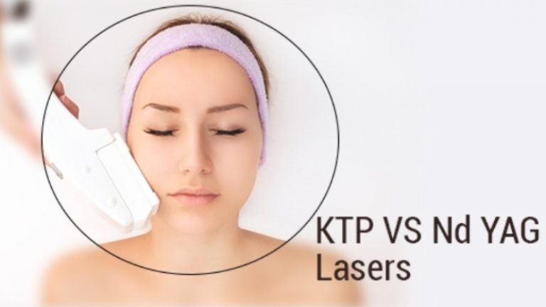 YAG Laser Treatment