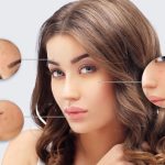 8 Tips On How To Remove Chickenpox Scars