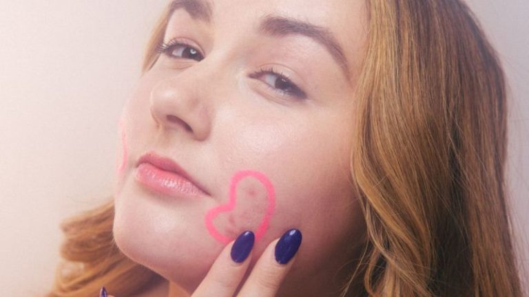 Learn About Acne Remedies